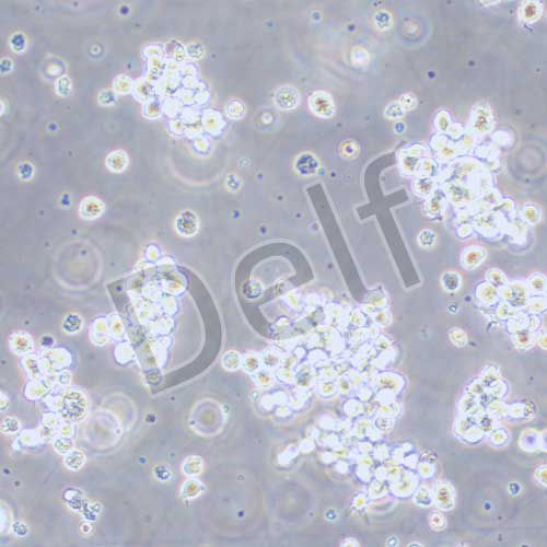 SU-DHL-2 人B細(xì)胞淋巴瘤細(xì)胞