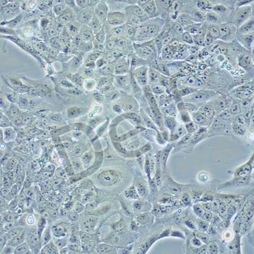 SV-HUC-1 人輸尿管上皮永生化細(xì)胞