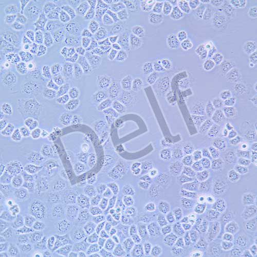SW-13 人腎上腺皮質癌細胞