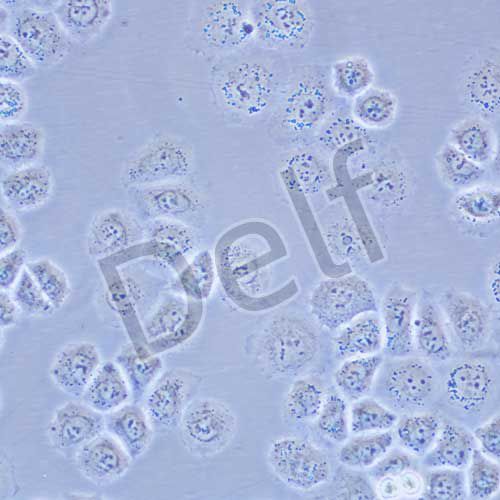SW-13 人腎上腺皮質癌細胞