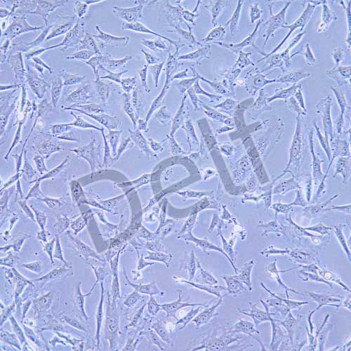 SW579 人甲狀腺癌細(xì)胞