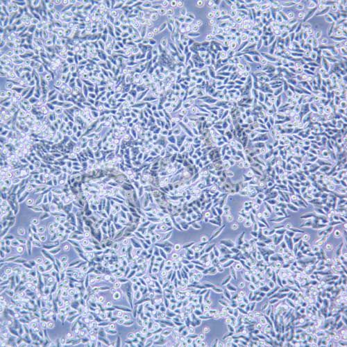 SW620 人結(jié)直腸腺癌細(xì)胞
