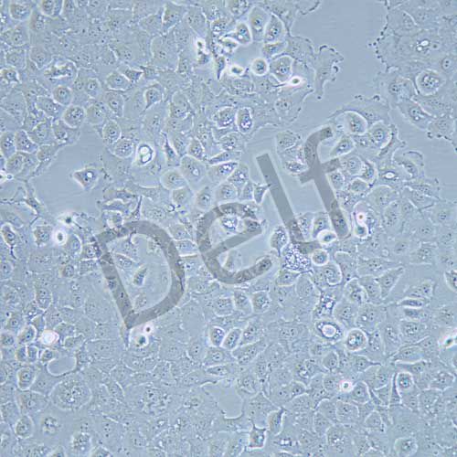 SW-780 人膀胱移行細胞癌