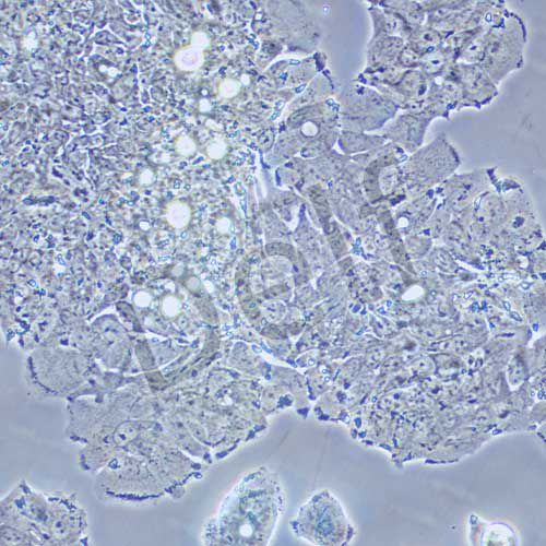 SW948 人結(jié)腸腺癌細(xì)胞