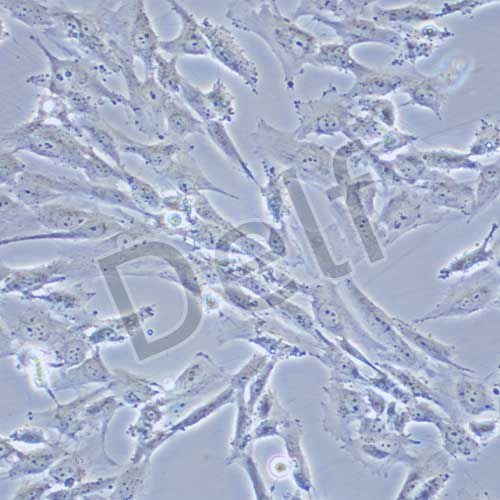 SW982 人滑膜肉瘤細(xì)胞