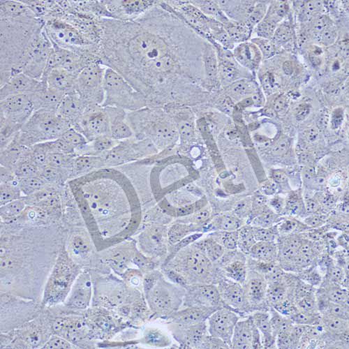 SW1990 人胰腺癌細(xì)胞