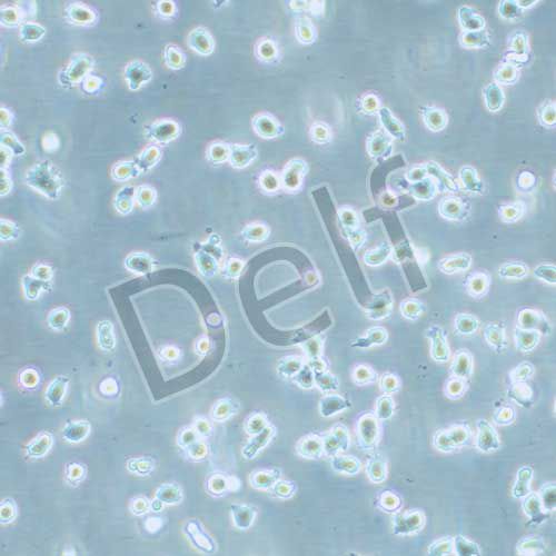 T2 (174xcem.T2 )人淋巴母細(xì)胞