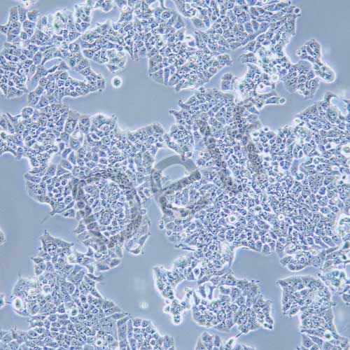 T47D 人乳腺導(dǎo)管癌細胞