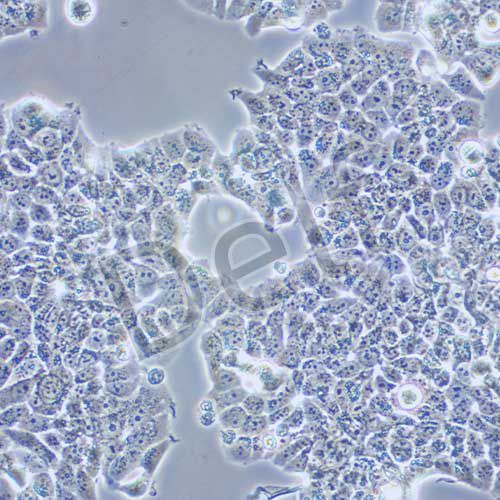 T47D 人乳腺導(dǎo)管癌細胞