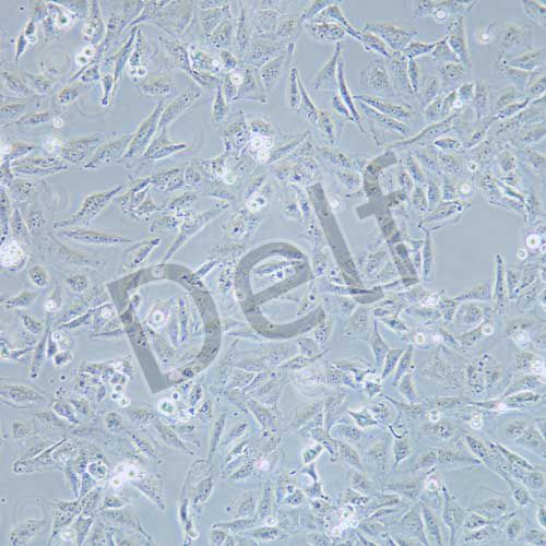 TCCSUP 人膀胱癌細(xì)胞