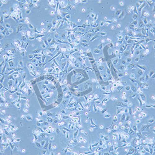 TE-1 人食管癌細胞