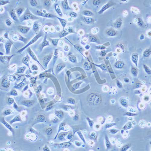 TE-1 人食管癌細胞