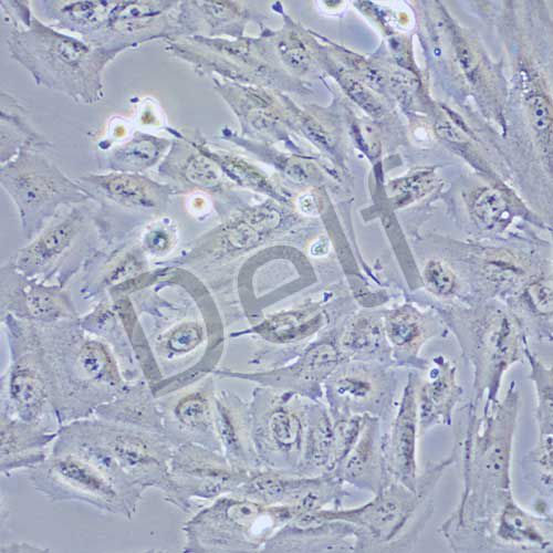 TJ905 人膠質(zhì)瘤細(xì)胞