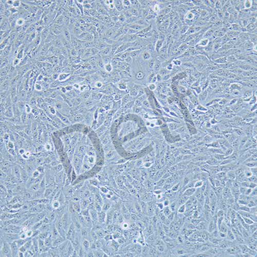 TPC-1 人乳頭狀甲狀腺癌細(xì)胞