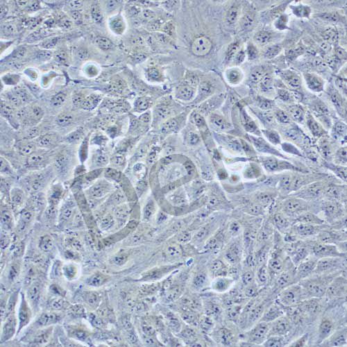 TPC-1 人乳頭狀甲狀腺癌細(xì)胞
