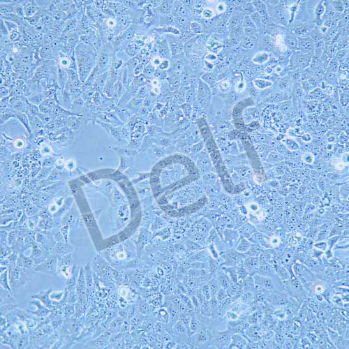 TU138 人喉癌細胞