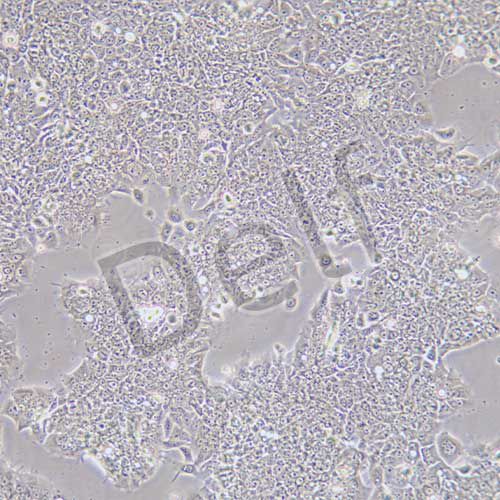 TU212 人喉癌細(xì)胞