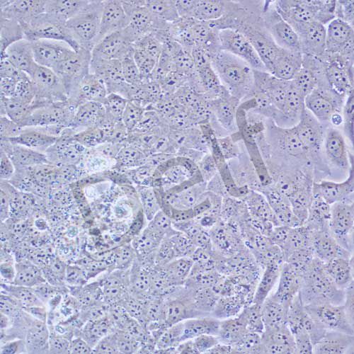 TU686 人喉癌細(xì)胞