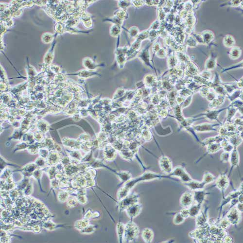 U14 小鼠子宮頸癌細(xì)胞