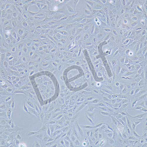 U2OS 人骨肉瘤細(xì)胞