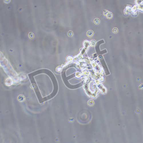 WERI-RB-1 人視網(wǎng)膜神經(jīng)膠質(zhì)瘤細(xì)胞