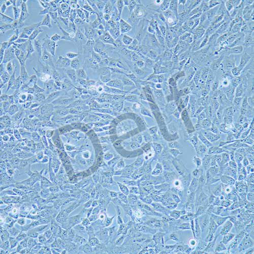 WPMY-1 人正常前列腺基質(zhì)永生化細(xì)胞