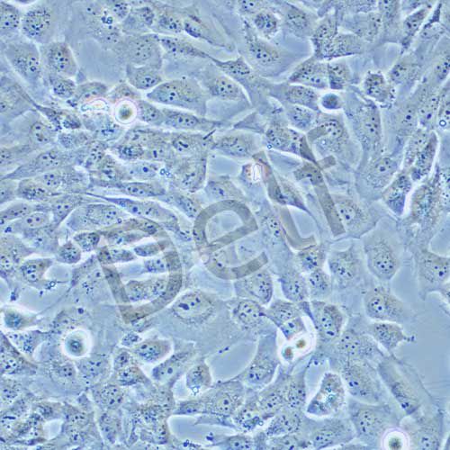 WPMY-1 人正常前列腺基質(zhì)永生化細(xì)胞