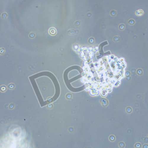 Y79 人視網(wǎng)膜母細(xì)胞瘤細(xì)胞