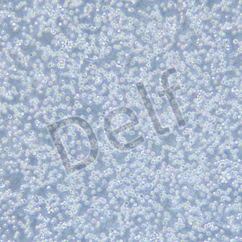 YAC-1 小鼠淋巴瘤細(xì)胞