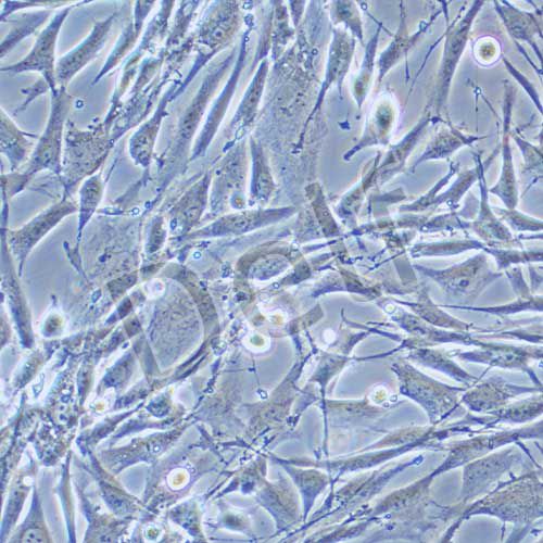 U118MG 人腦星形膠質(zhì)母細(xì)胞瘤