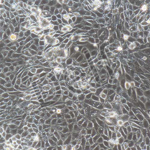 大鼠原代Ⅱ型肺泡上皮細胞