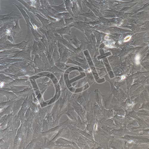 大鼠原代膀胱基質(zhì)成纖維細(xì)胞