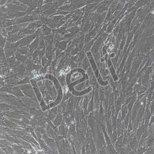 大鼠原代肺動(dòng)脈平滑肌細(xì)胞