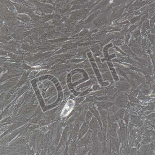 大鼠原代肺動(dòng)脈平滑肌細(xì)胞