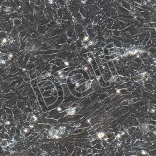 大鼠原代肺微血管內(nèi)皮細(xì)胞