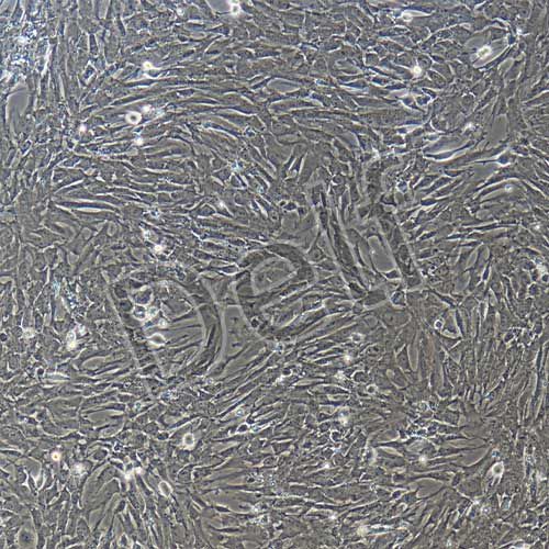 大鼠原代肝星狀細(xì)胞