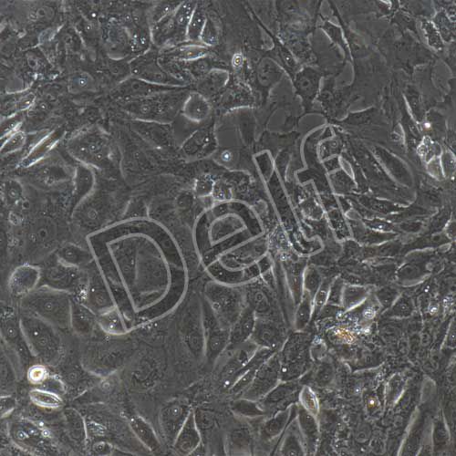 大鼠原代腦微血管內(nèi)皮細(xì)胞