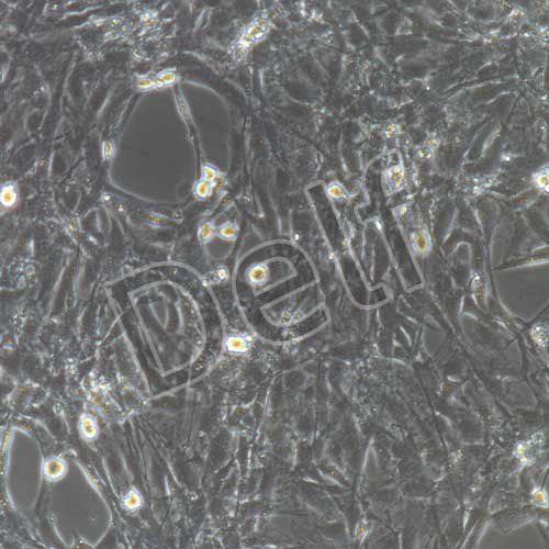 大鼠原代內(nèi)皮祖細(xì)胞