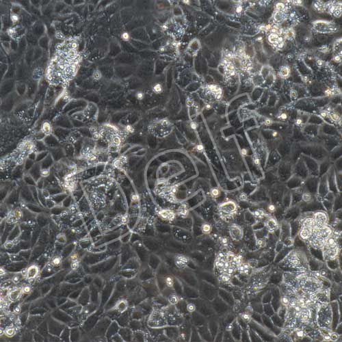 大鼠原代臍靜脈內(nèi)皮細(xì)胞