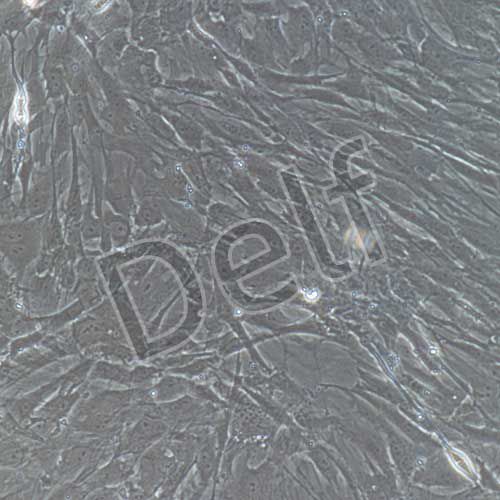 大鼠原代視網(wǎng)膜muller細(xì)胞