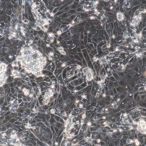 大鼠原代視網(wǎng)膜色素上皮細(xì)胞