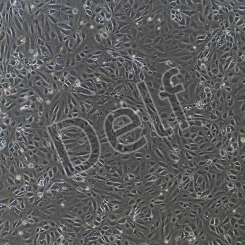 大鼠原代主動(dòng)脈內(nèi)皮細(xì)胞