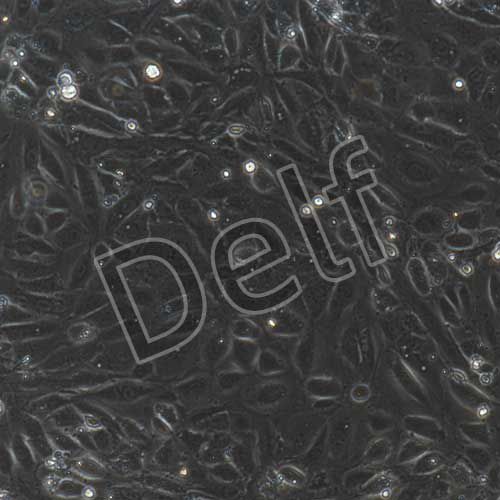 大鼠原代主動(dòng)脈內(nèi)皮細(xì)胞