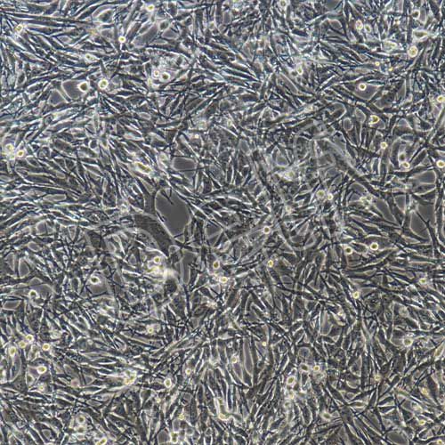 U-251MG/Temozolomide(人神經膠質細胞瘤細胞替莫唑胺耐藥株)