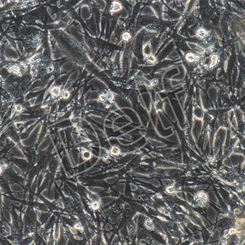 U-251MG/Temozolomide(人神經膠質細胞瘤細胞替莫唑胺耐藥株)