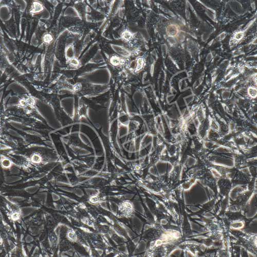 U-251MG/Temozolomide(人神經膠質細胞瘤細胞替莫唑胺耐藥株)