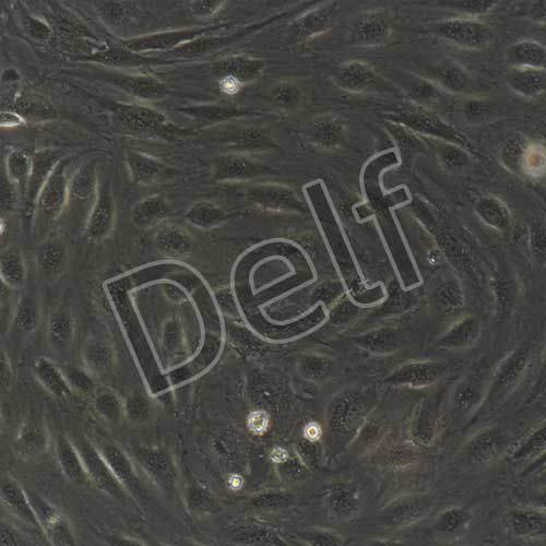 HUVEC 人臍靜脈內皮細胞永生化