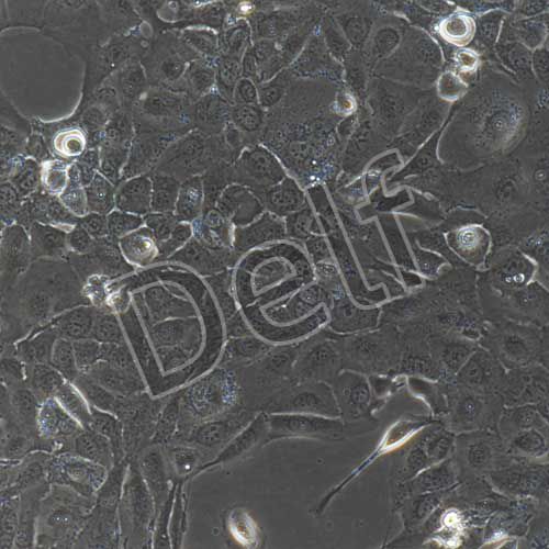 人原代Ⅱ型肺泡上皮細(xì)胞