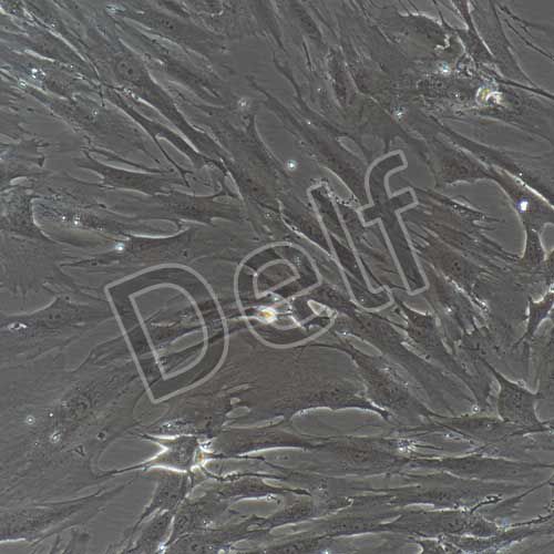 人原代膀胱成纖維細(xì)胞