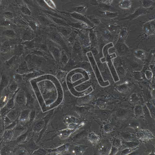 人原代肺微血管內(nèi)皮細胞